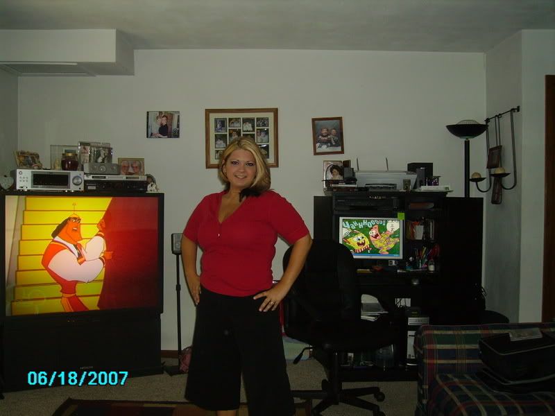 me3monthsaftersurgery003.jpg